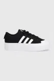 Črni Adidas čevlji image
